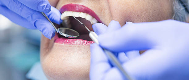 Best Emergency Gum Treatment in Syracuse, KS
